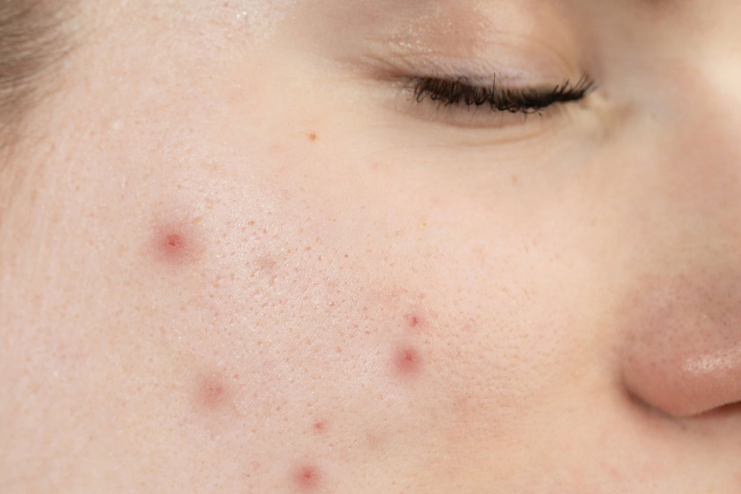 Pem Delian Perfector arctisztító gél bőrön gyakorolt hatása csukott szemű modellen