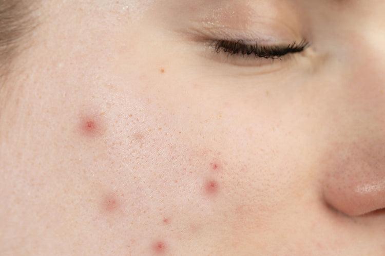 Pem Delian Perfector arctisztító gél bőrön gyakorolt hatása csukott szemű modellen