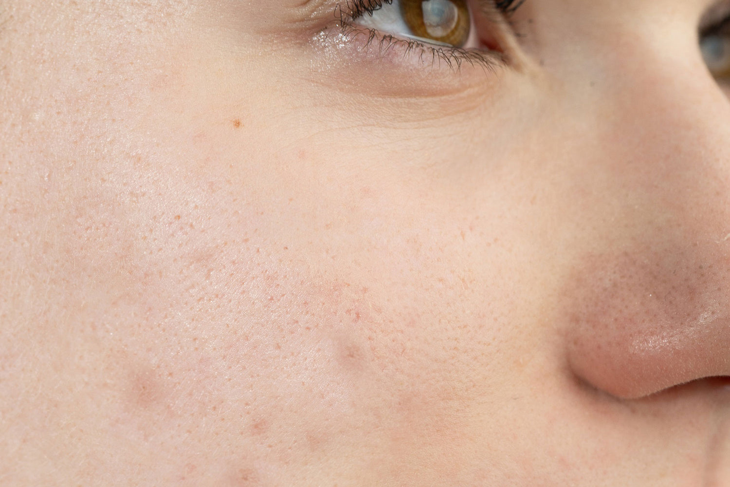 Pem Delian Perfector arctisztító gél bőrön gyakorolt hatása