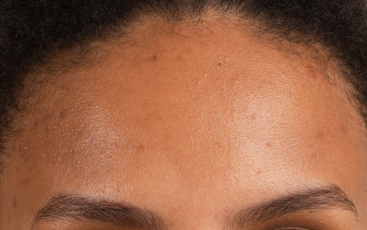 Pem Delian Purist előtt a modell homloka